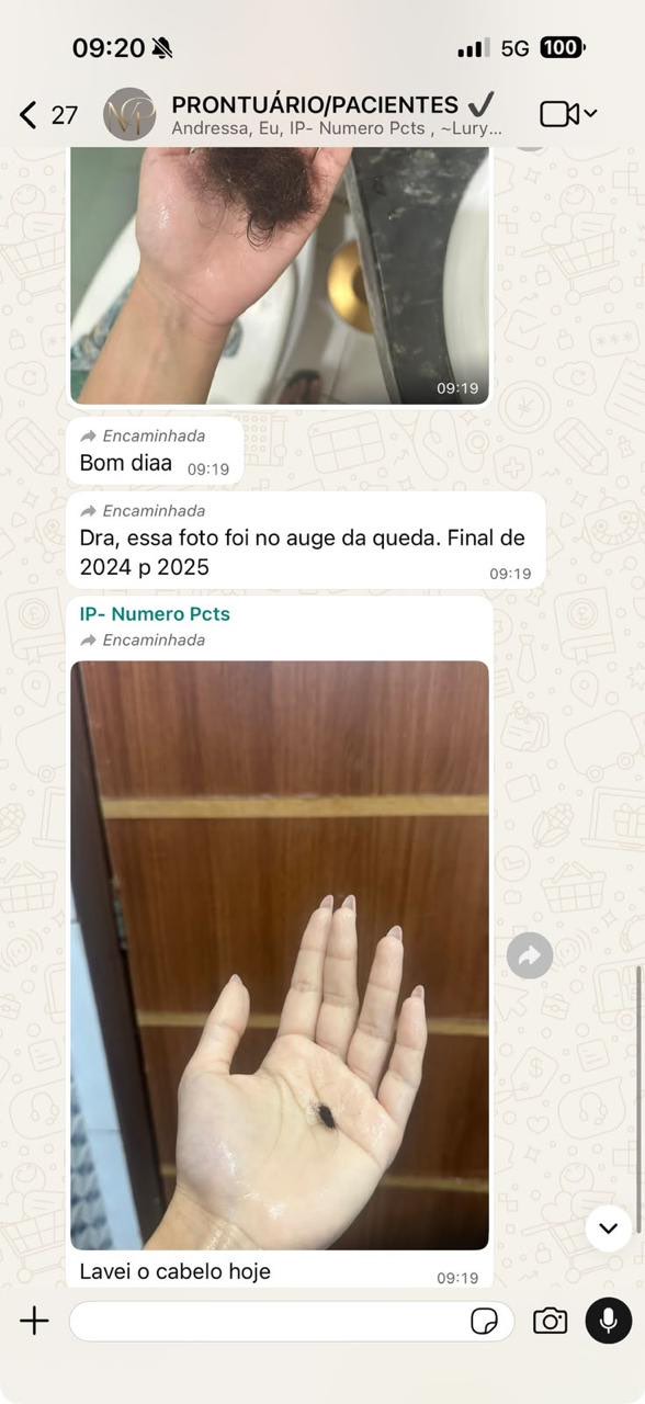 Print real da conversa de uma paciente com o consultório, mostrando a redução da queda de cabelo