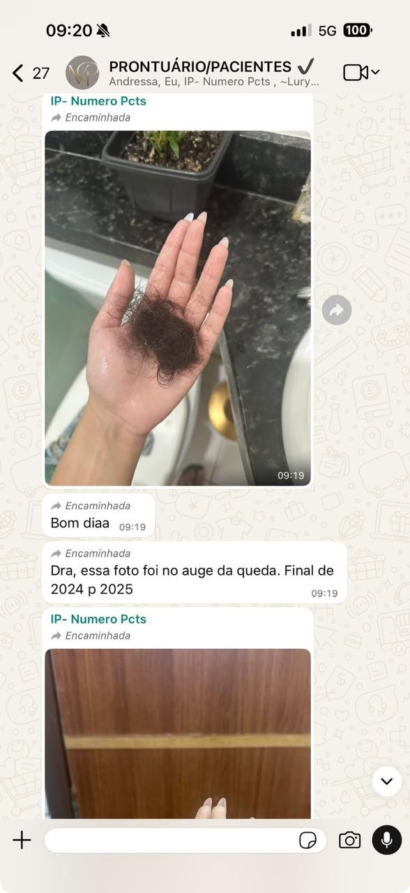 Print real da conversa de uma paciente com o consultório, mostrando a redução da queda de cabelo